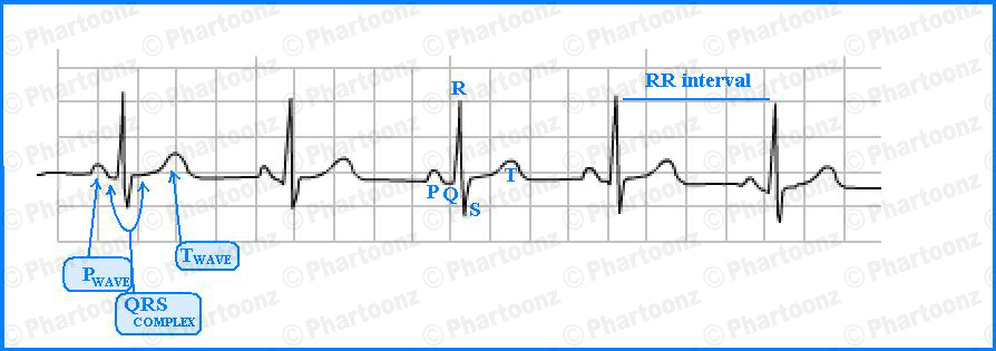 How To Read A Contraction Chart