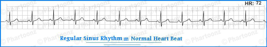 Ecg Chart Normal