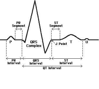 Ecg Interpretation Chart