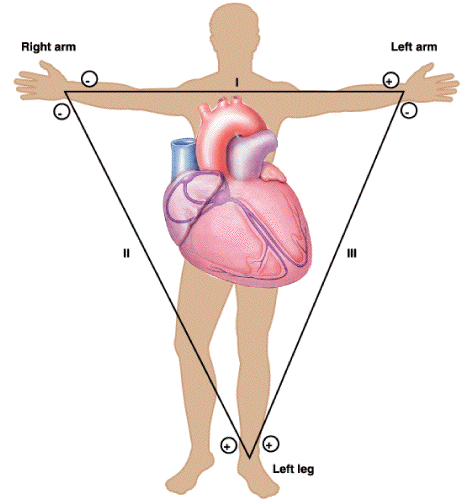 Ecg Electrode Placement Chart
