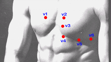 Ekg Placement Chart