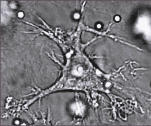 Dendritic_cell_leukocytes