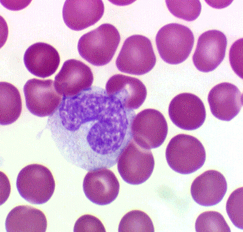 MONOCYTEs_leukocytes