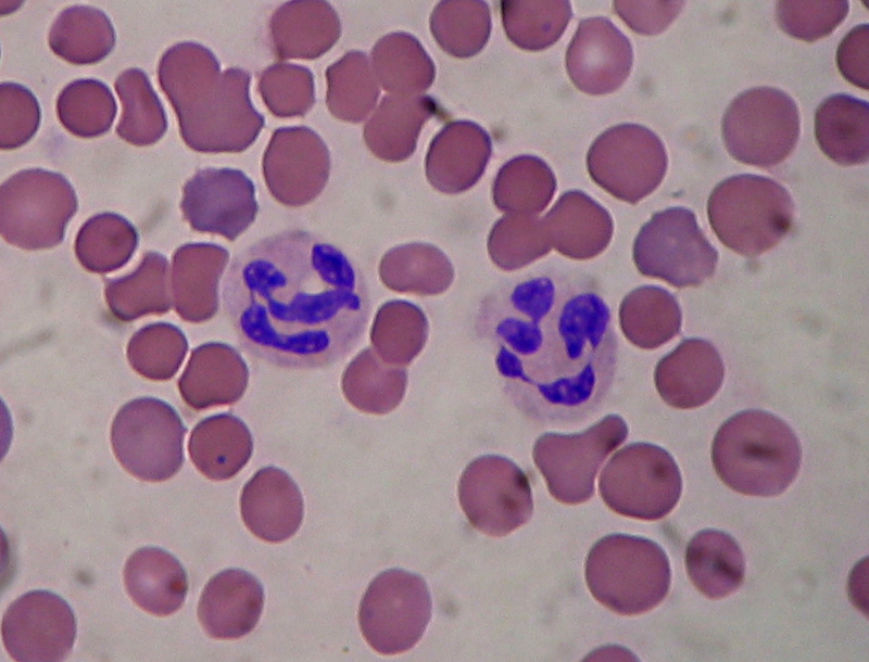 immunity_leukocytes_neutrophils