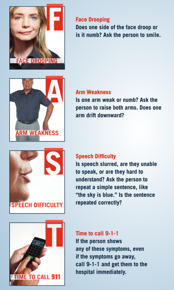 Stroke at a glance F.A.S.T Signs Phartoonz